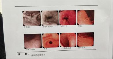 反复腹痛腹胀是什么原因,不明原因的腹胀难忍