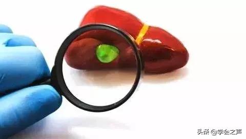 肉肿瘤最简单的去除方法,肉里长瘤子会癌变吗