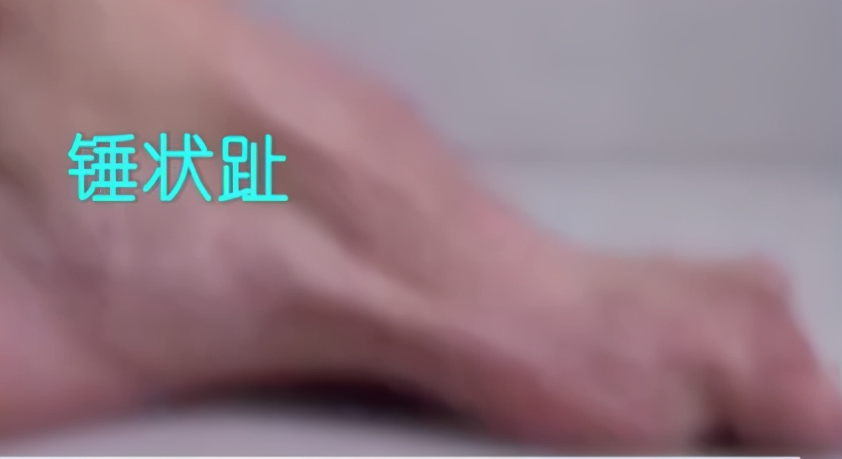 怎么选择适合自己脚型的鞋,怎样选一款适合自己脚型的鞋