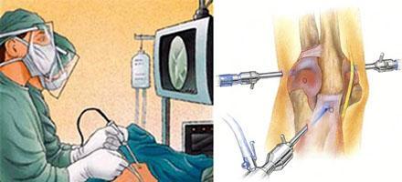 “医生,我胳膊肘伸不直了,还用不了筷子了,我是怎么了啊?”