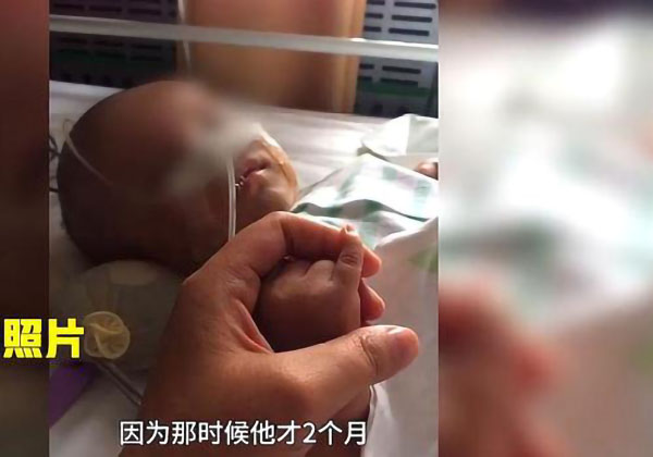 小孩不小心撞到脸怎么办,孩子不小心撞到头怎么办