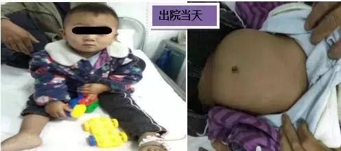 为什么手接触高温不会被烫伤,被烫伤的地方为什么会发热