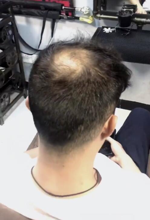 能掩盖发际线的发型,掩盖秃顶的发型男