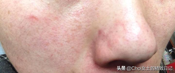 冻干粉,干粉适合冬天用吗