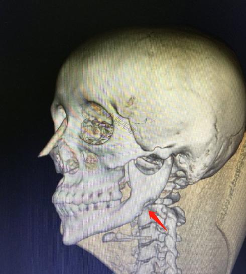 整形医生如何提高审美,十年前的整形审美和现在的审美