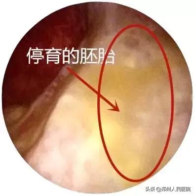 这个小镜子，照看着世上最贵的“房子”