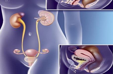 女性尿失禁应注意哪些事项,尿失禁的女性在生活上应注意什么