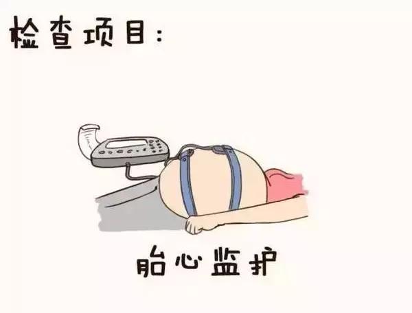 孕妇产检全流程手绘图,产科医生画图