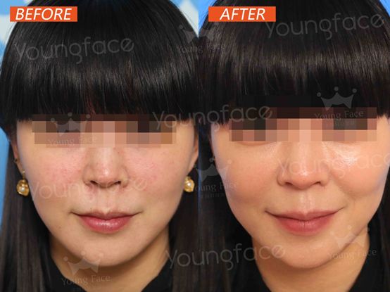 低至1元享星级护肤体验！小编亲测，十一月回血就靠它了