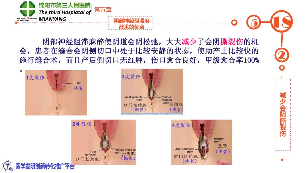 会阴阻滞麻醉操作流程,会阴阻滞麻醉操作方法