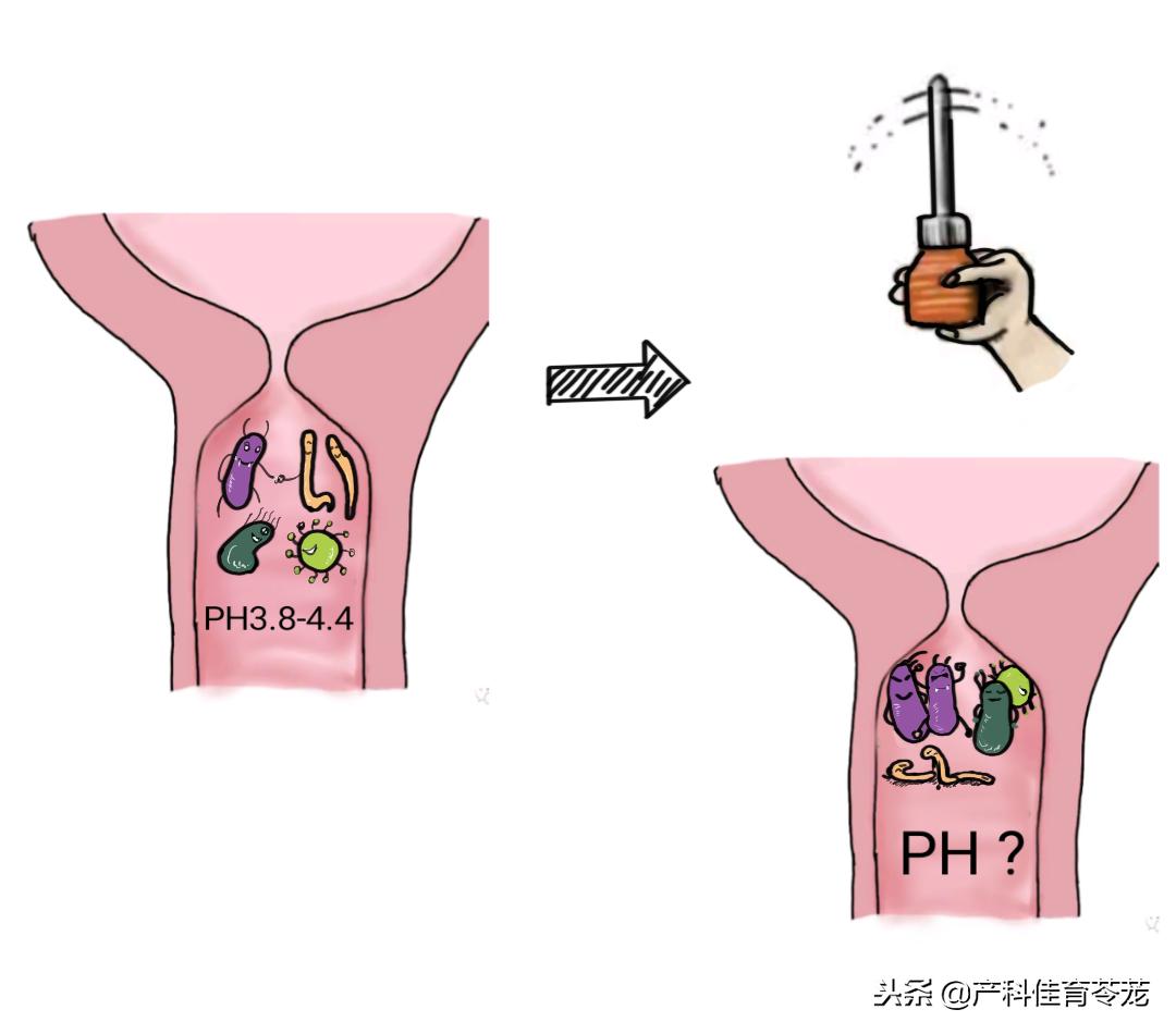 用碱洗外阴会生儿子吗,用碱洗屁屁可以生儿子吗