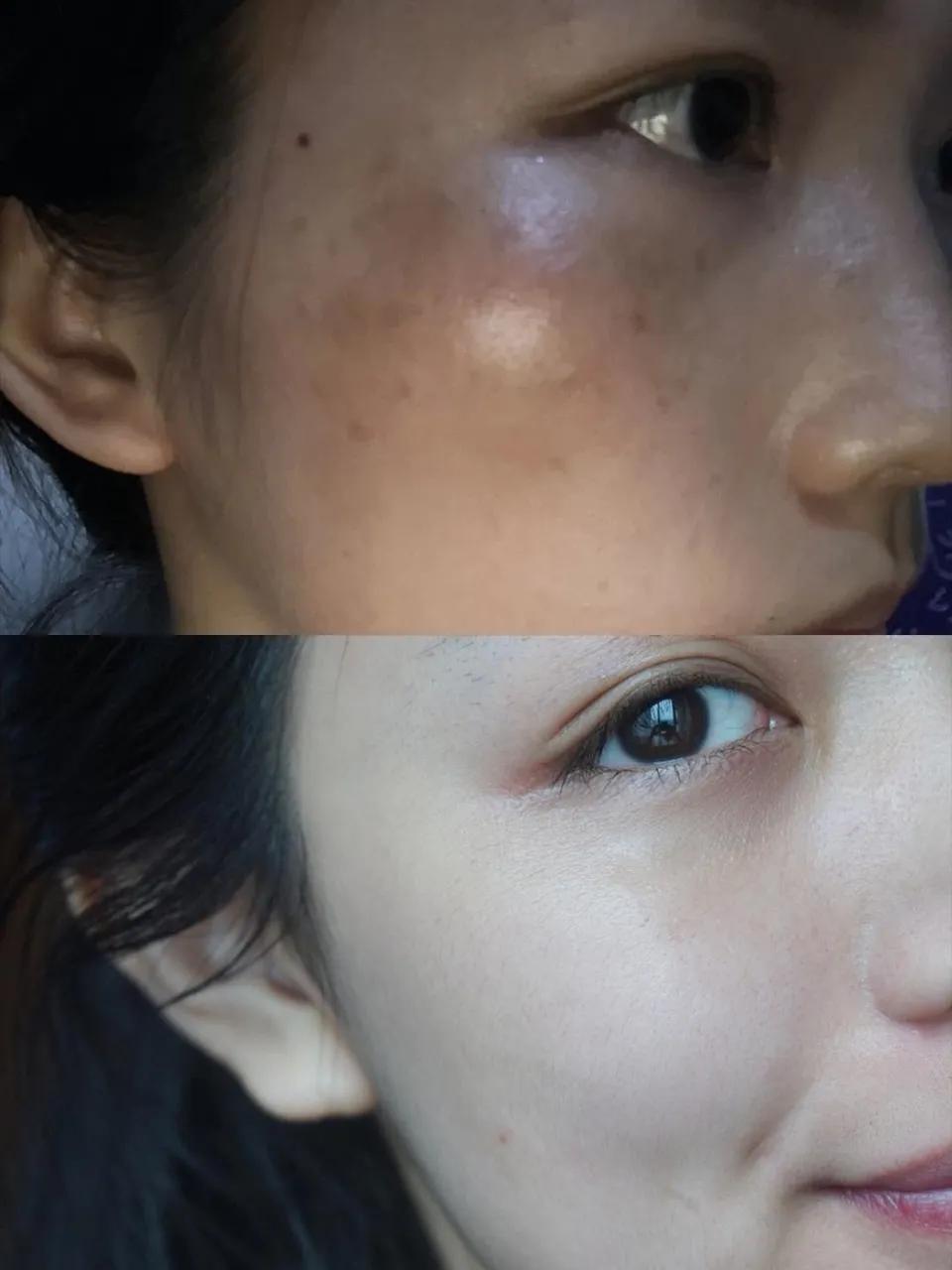 斑点女孩,斑点女生逆袭之路