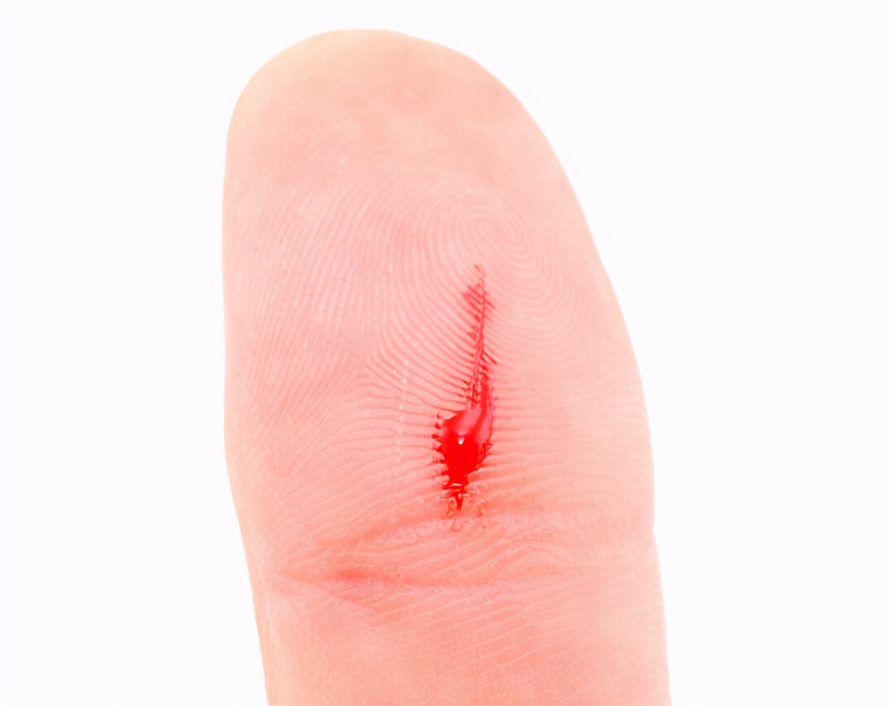 女性排便有粘液,排便有问题小心妇科疾病