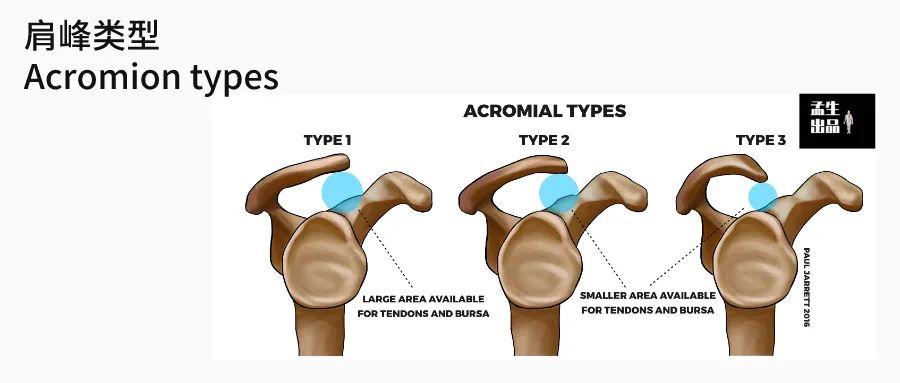 肩关节与肩胛骨的结构图,肩胛骨深层肌肉解剖图