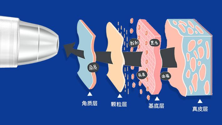 解决顽固黑头轻松去除草莓鼻,祛闭口粉刺草莓鼻