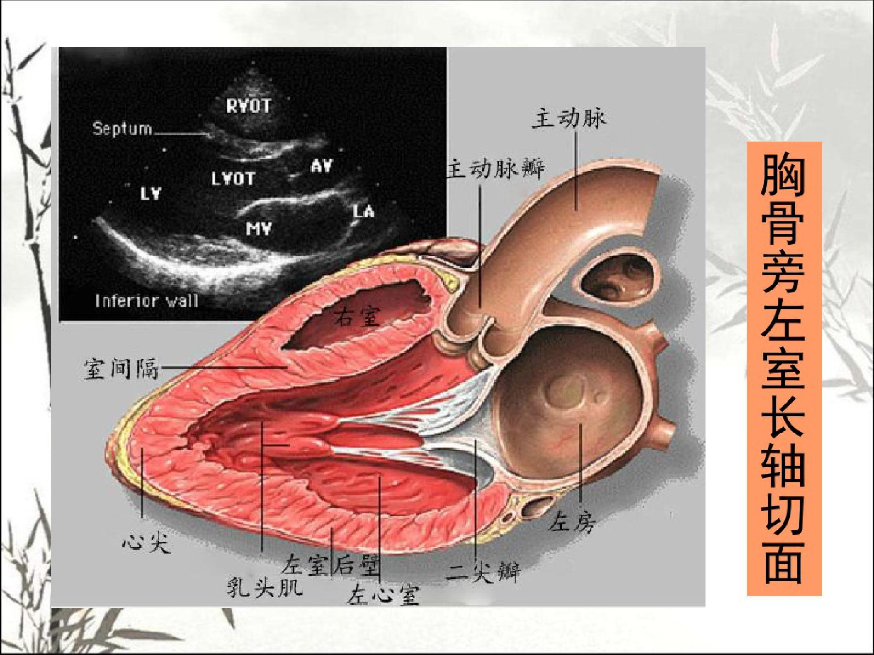 心脏彩超和动态心电图哪个准确,心电图跟心脏彩超哪个更准确
