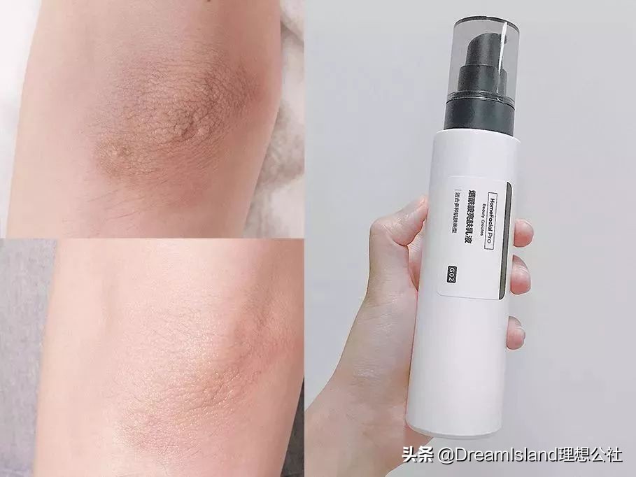 皮肤太白会不会有问题,皮肤太白涂什么好