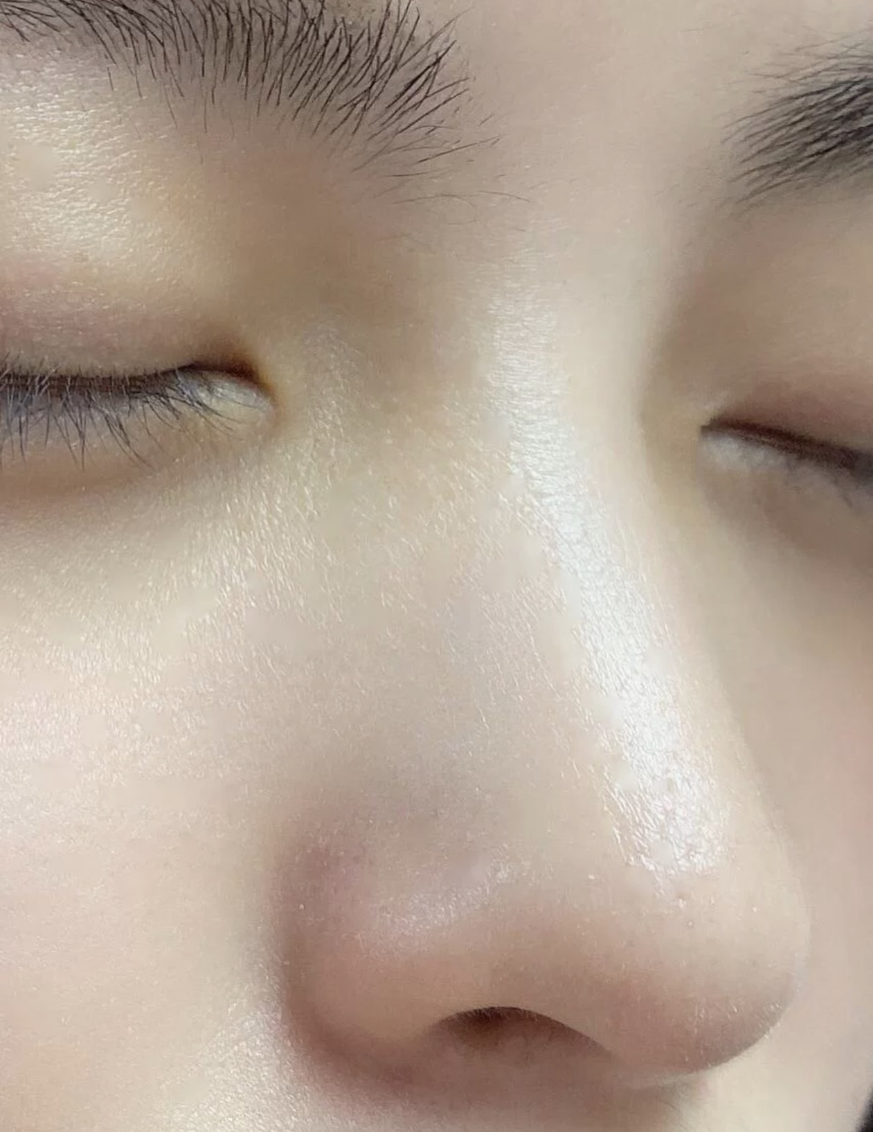 去黑头的几大“雷品”!城野医生用处不大,黑炭硬撕你敢用?