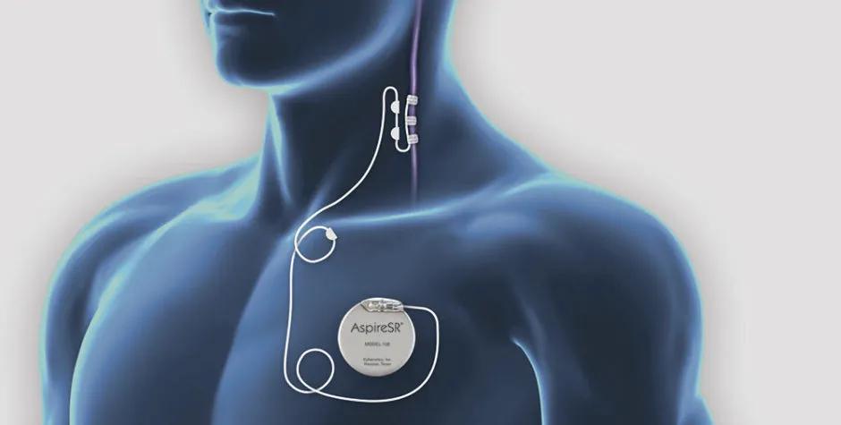 神经调控技术发展前景,神经调控前沿疗法