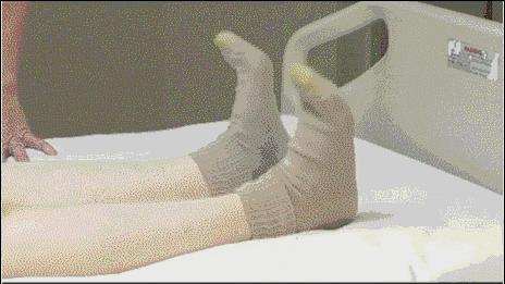 骨科术后康复训练要多久,骨科手术20天后恢复