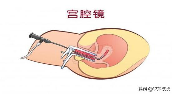 宫腔镜做完多久可以移植,做完宫腔镜多久可以洗澡