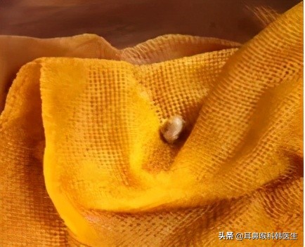 为啥来院就做内镜检查？医生怕是在骗我钱吧