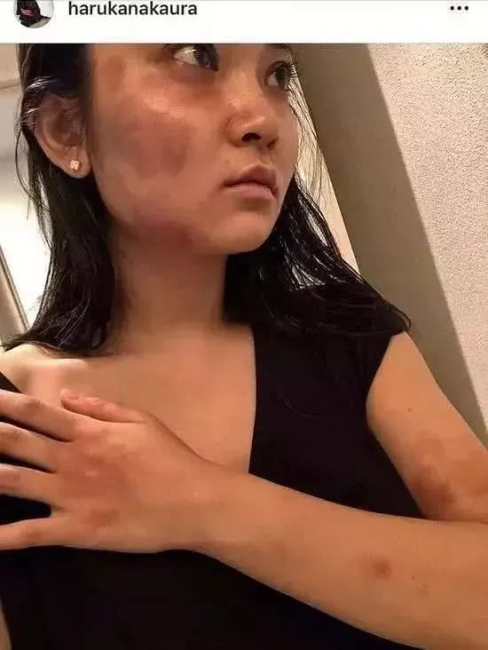 蒋劲夫家暴事件怎么处理,蒋劲夫回应家暴事件