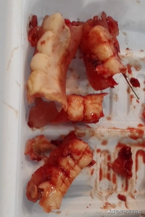 别再这样镶牙啦，孝顺就转给父母看看吧！