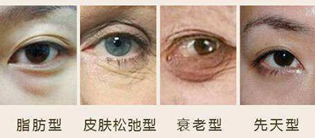 滤镜还是拯救不了眼袋,适合有眼袋的滤镜