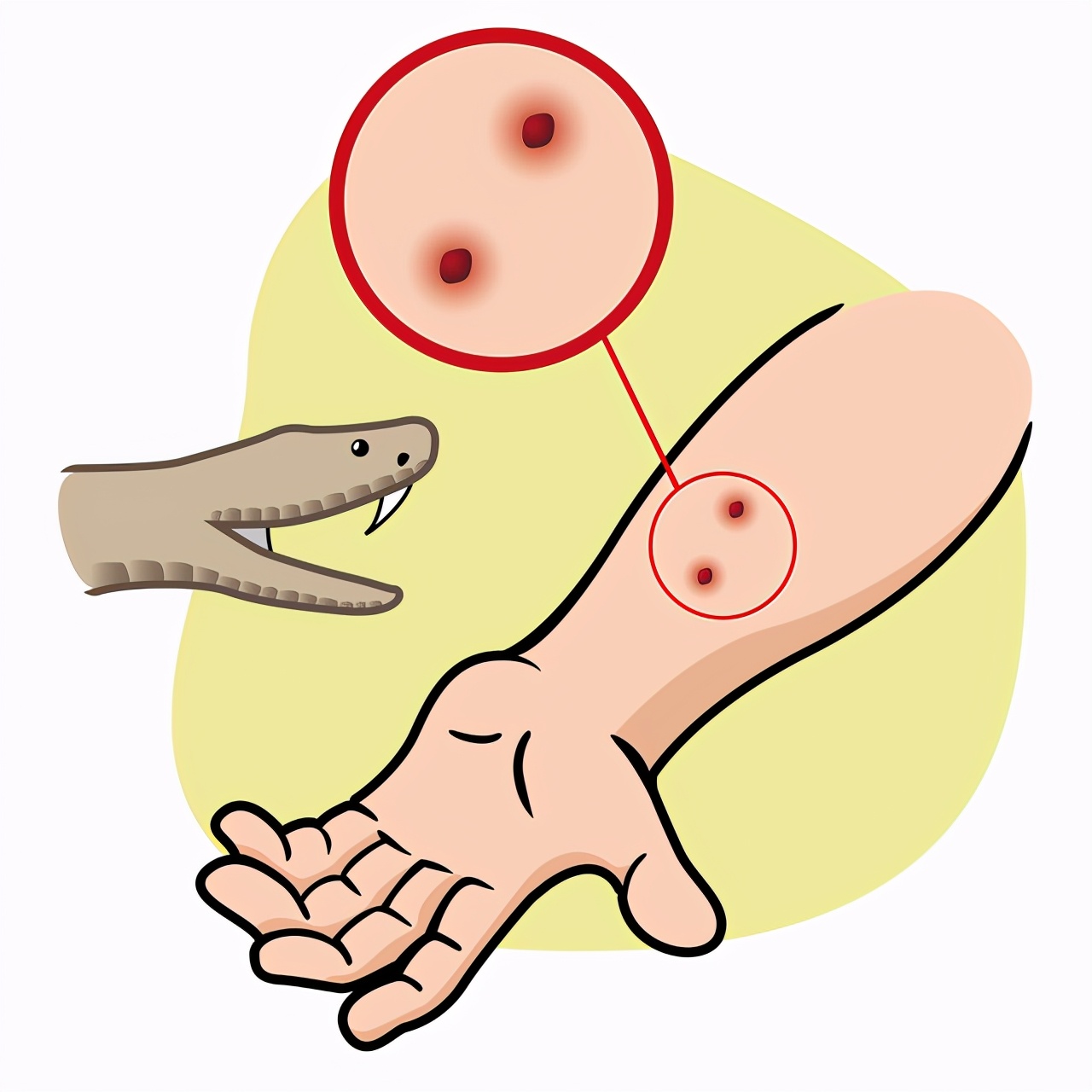 浙江男子走夜路被剧毒蛇咬，成功自救！做法实用，比教科书还经典