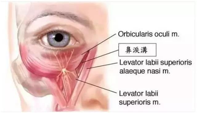 如何让泪沟消失小技巧,泪沟真的毫无办法吗
