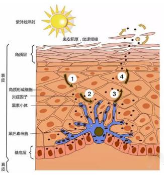 夏天晒黑怎么恢复美白,夏天晒黑了怎么快速变白