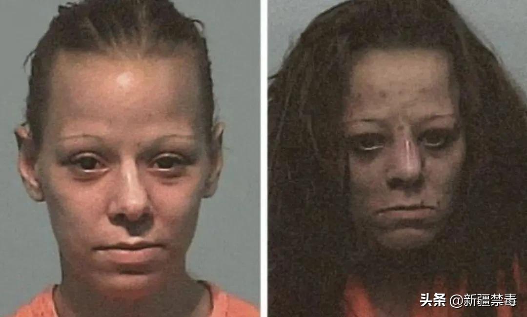 “我的笑容就像一个空洞!”22岁女子吸毒6年,瘦到脸凹牙拔光…