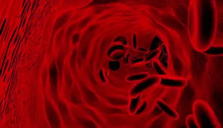 吃肉会引发心血管疾病吗,心脏不好同型半胱氨酸高说明什么