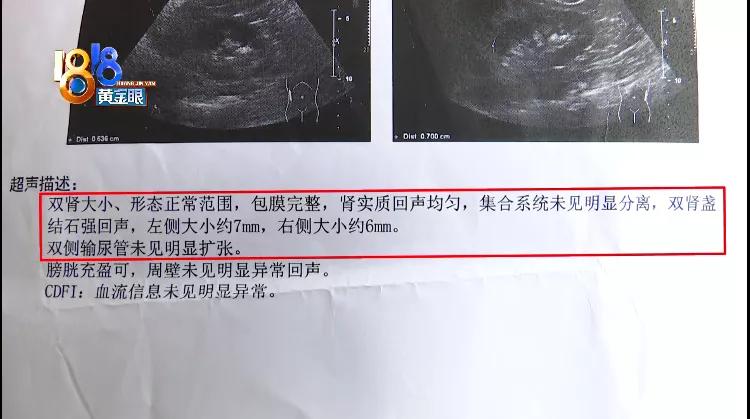 肾支架后小便出血怎么办,输尿管支架术后尿出血块