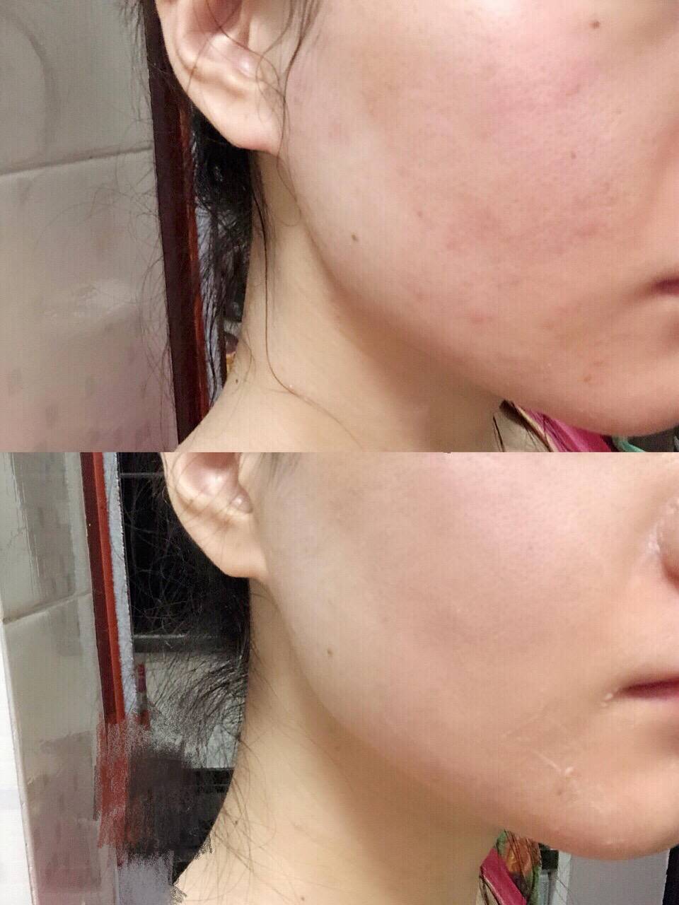 盘点三款懒人必备的面霜,必备的八款面霜好用到飞起