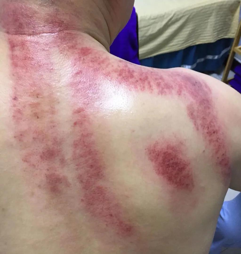 中医头疗养生馆,中医头疗按摩