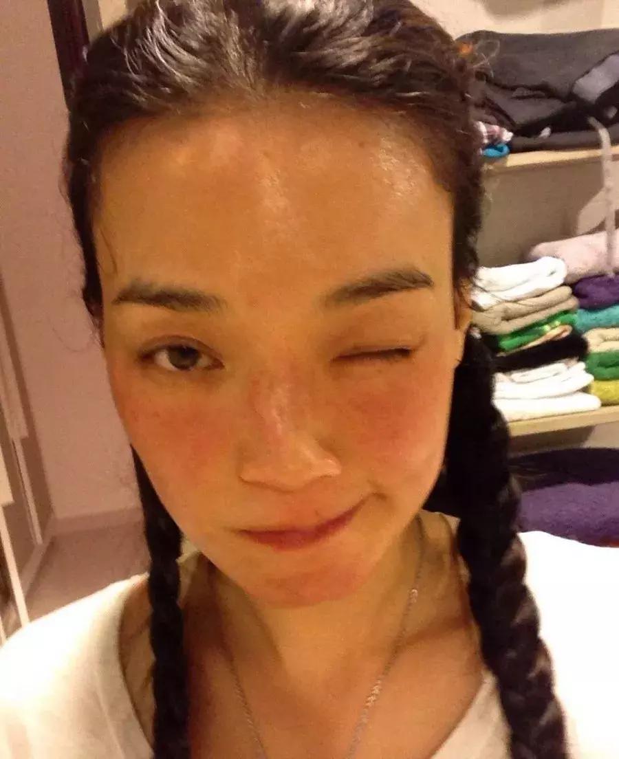 换季皮肤干起皮急救方法,换季皮肤干痒怎么修复