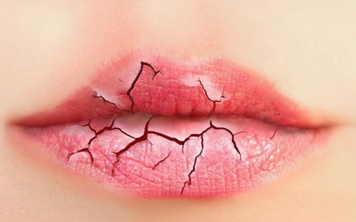 唇膏越用越干越起皮怎么回事,唇膏涂了起皮怎么回事