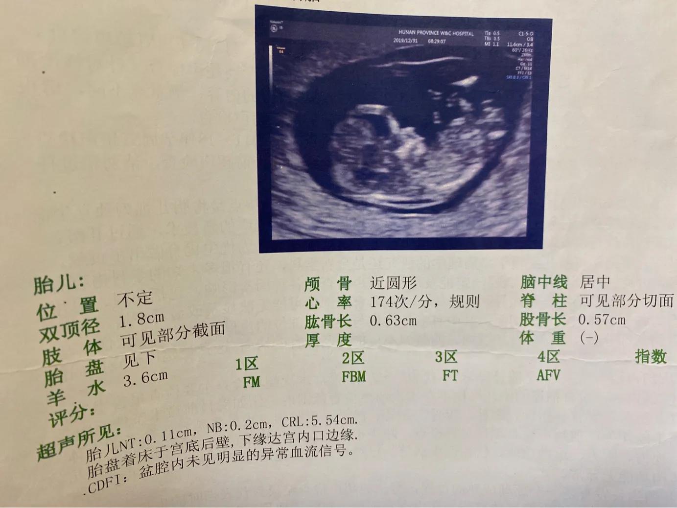 长沙市社区医院孕期免费检查项目,长沙医院孕妇检查