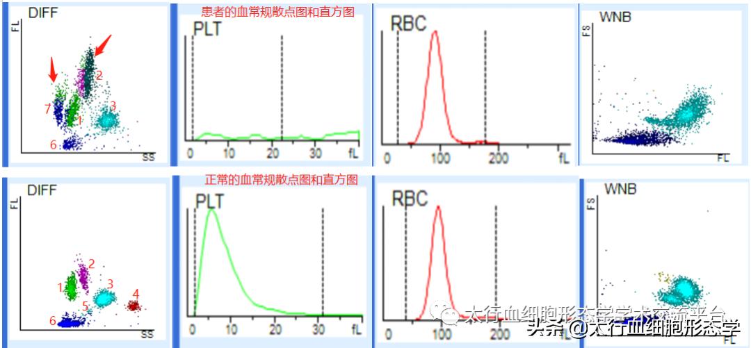 浆质体是什么,浆质体图片