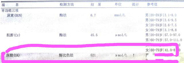 喝茶对尿酸高会不会有所改善,尿酸5.21喝什么茶能降低尿酸