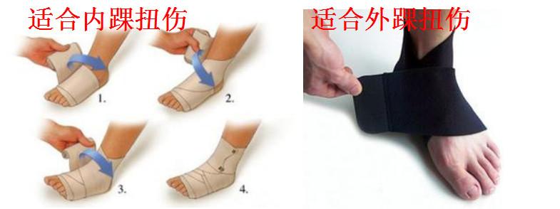 踝关节扭伤正确的处理方式是什么,踝关节扭伤的表现及处理方法