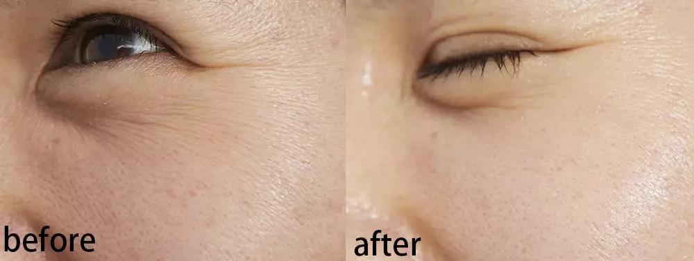 真人改造|不靠医美，一天实现“换皮”