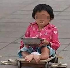 眼球被挖了还能接回去吗,眼球被挖掉了还能恢复么