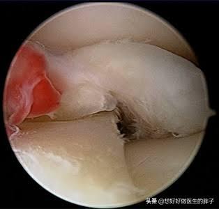 怎么走路才能缓解膝盖的疼痛,走路多了膝盖疼怎么康复锻炼