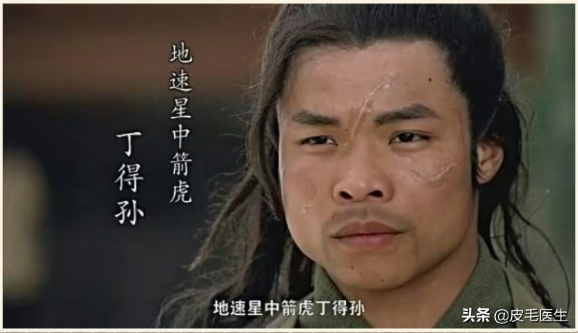 梁山好汉个人问题怎么解决,梁山好汉的通病