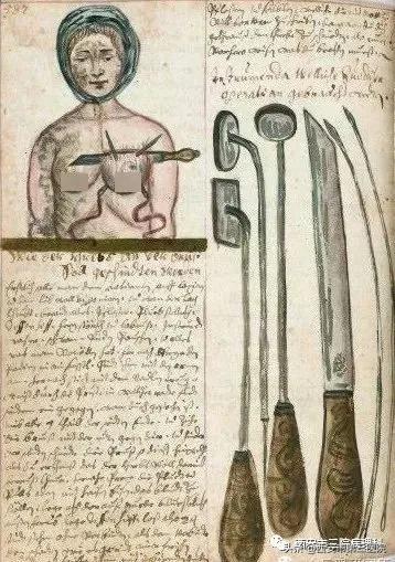 乳腺癌治疗史的不断演进,中医讲乳腺癌的真实故事