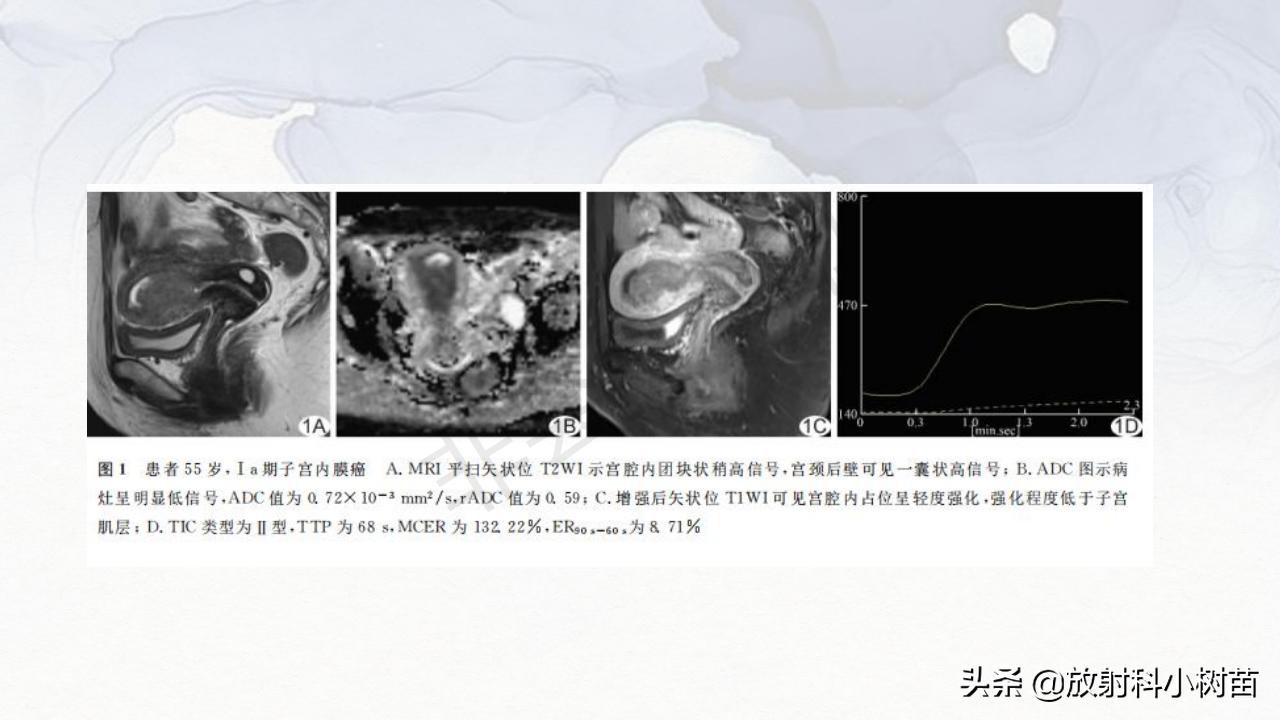 女性盆腔mri解剖图谱,泌尿生殖系统x线解剖