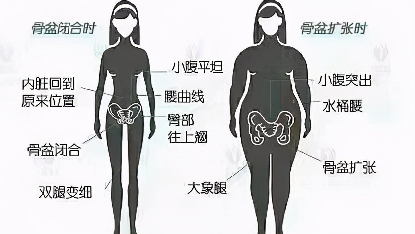 产后修复骨盆盆底肌几年内效果好,产后徒手修复骨盆前倾矫正的视频